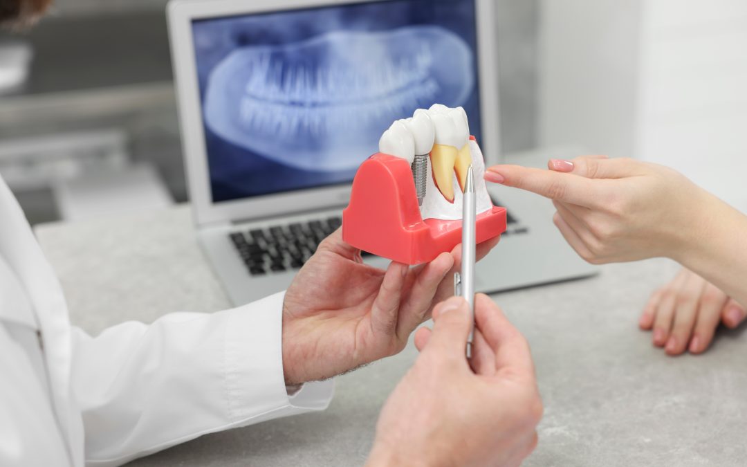 doctor showing a patient a model for dental implants, closeup