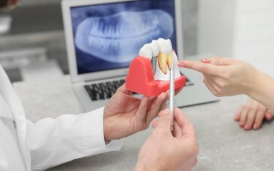 Dental Implants: The Gold Standard Tooth Replacement Option in Florence, KY
