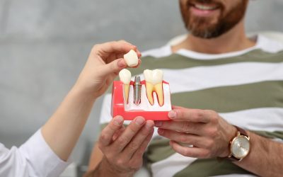 What to Look for in an Implant Dentist in Florence, KY